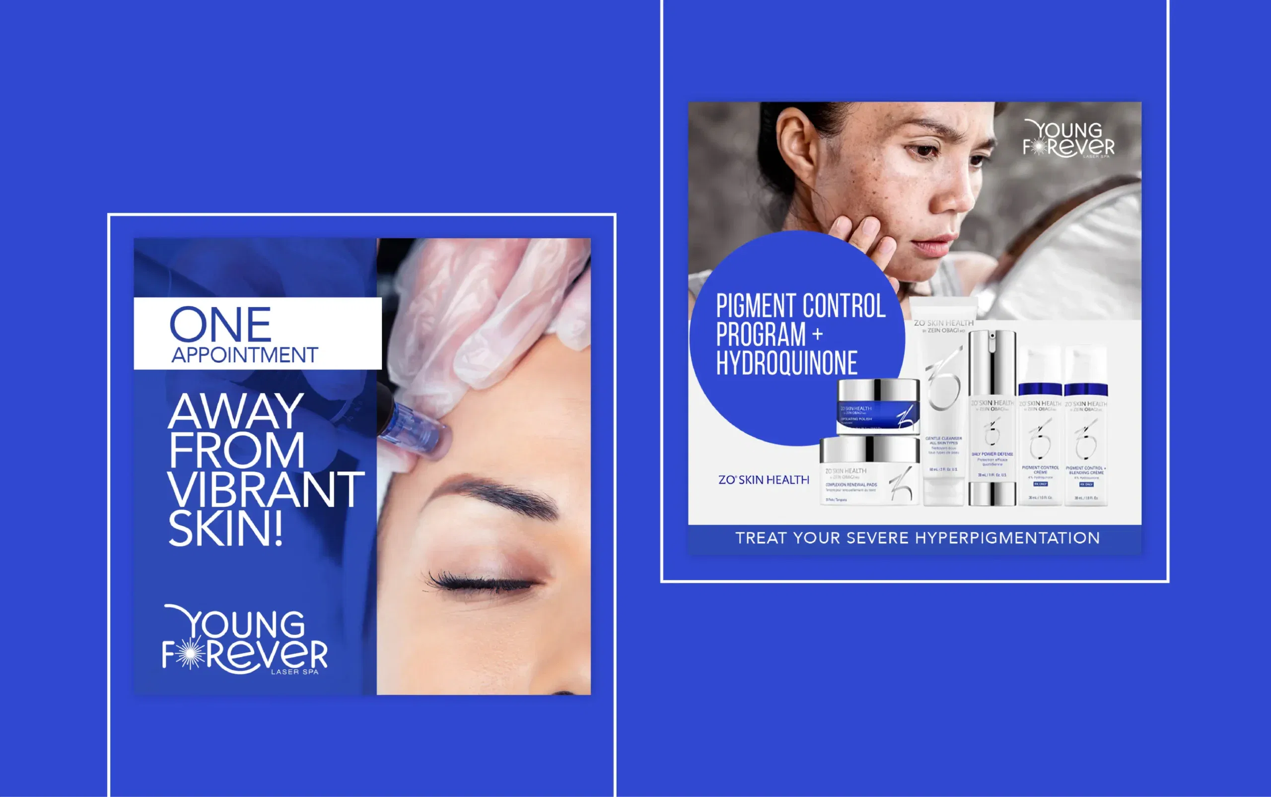 Skincare advertisement featuring facial treatment and pigment control products.