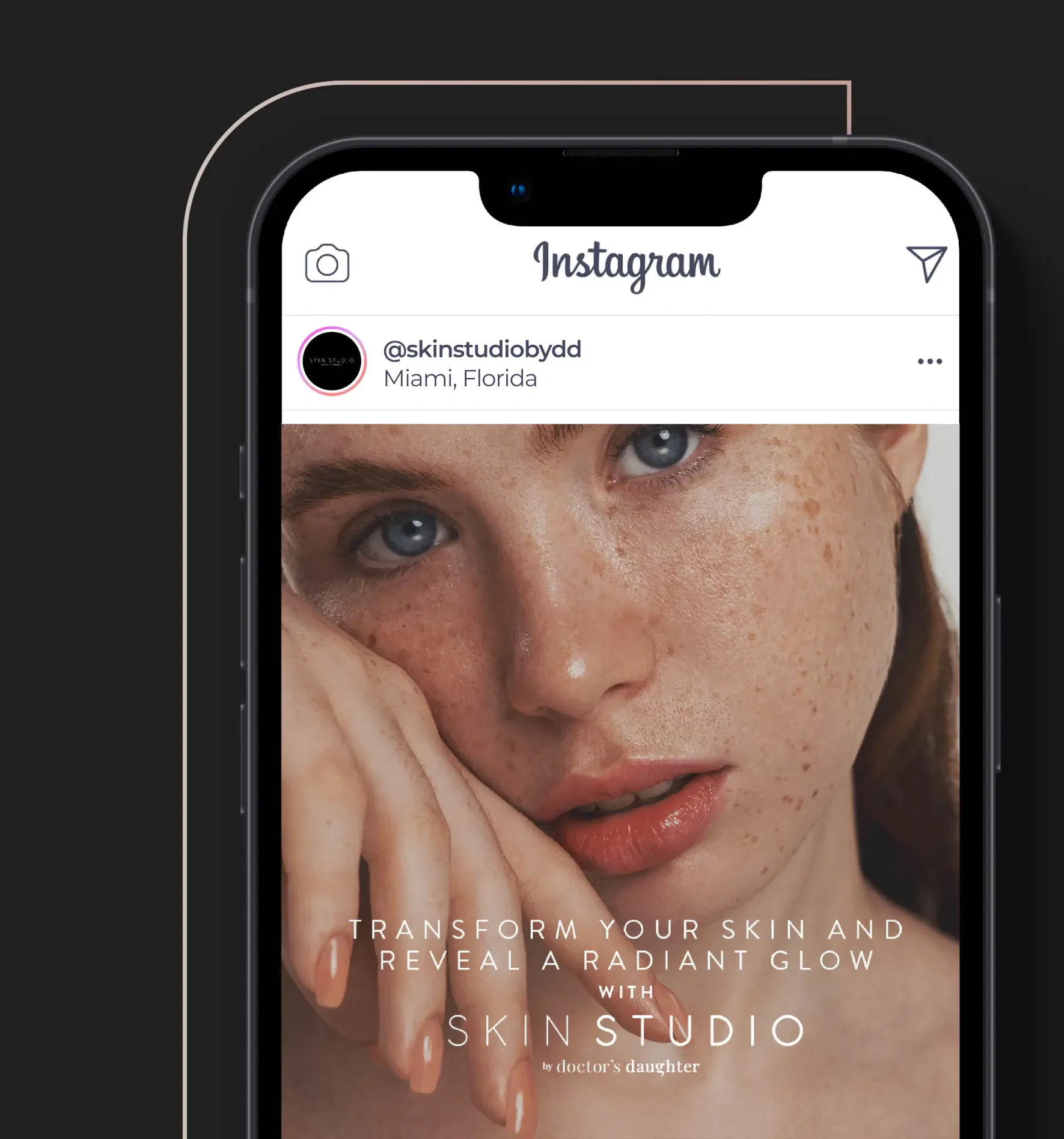 Close-up of a woman with freckles on a mobile screen showcasing a skincare brand's Instagram post.