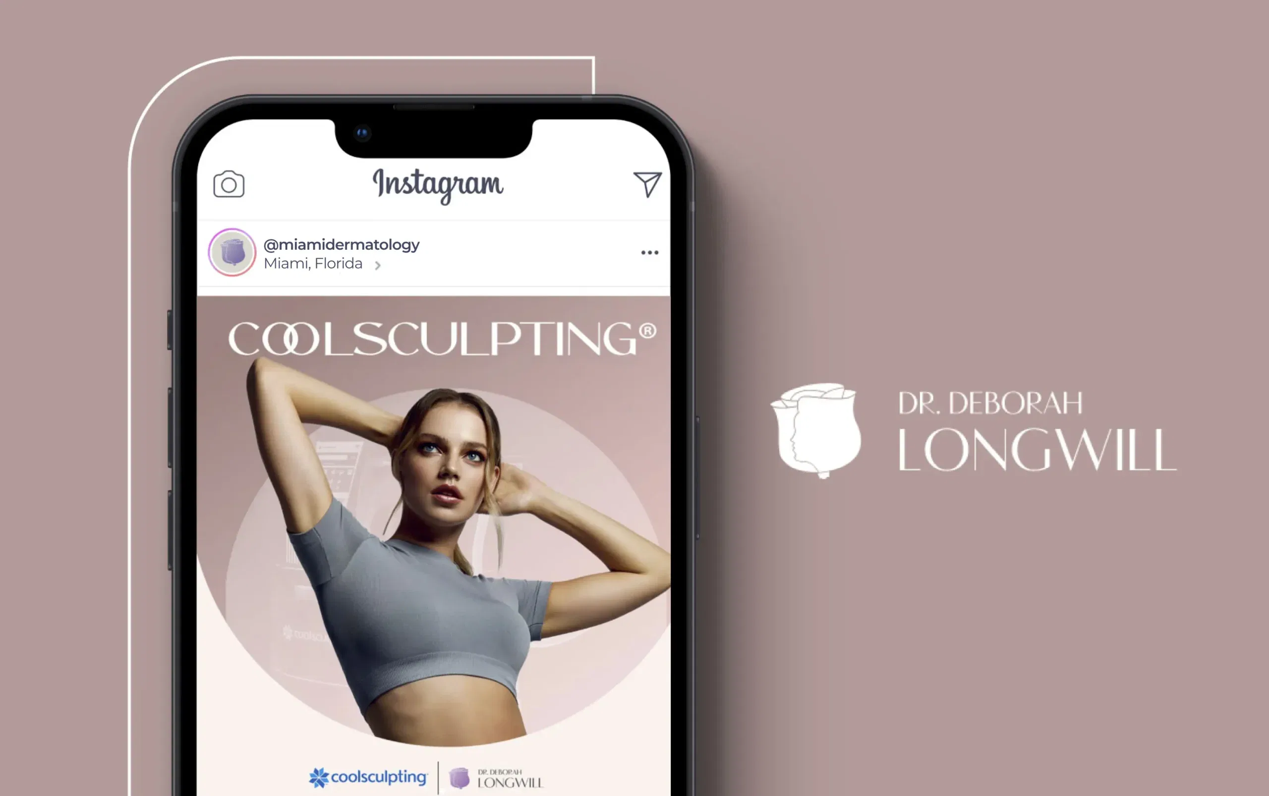 Woman in a cropped top under CoolSculpting banner on a smartphone screen.