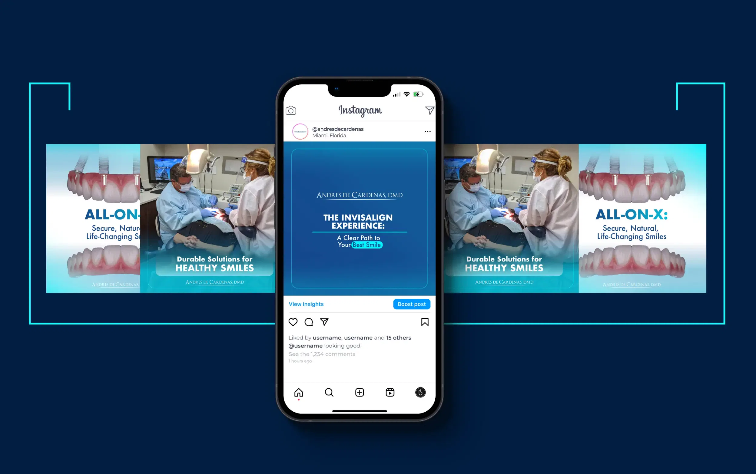 Phone showing Instagram post with dental surgery images in the background.